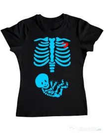 Tricou ADLER dama Radiografie Negru