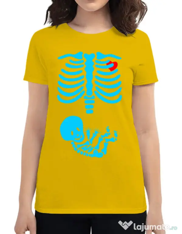 Tricou ADLER dama Radiografie Galben