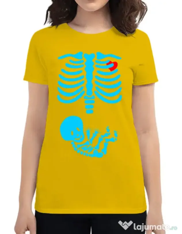 Tricou ADLER dama Radiografie Galben