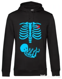 Hoodie barbat cu gluga Radiografie Negru