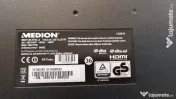 Dezmembrez medion 55" cu 17ips72 și 17mb120 