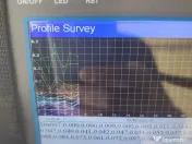 Scanare detectare apa izvoare pentru fântâna sau put 