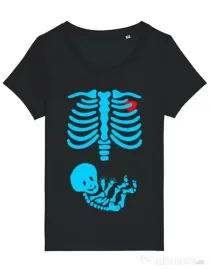 Tricou STANLEY STELLA dama Radiografie Negru