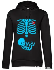 Hoodie dama cu gluga Radiografie Negru