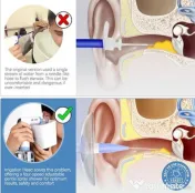 Set de curatare a urechilor, 4 moduri de presiune